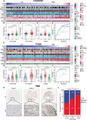 <mark class="highlighted">Transcriptome profile</mark> and clinical characterization of ICOS expression in gliomas